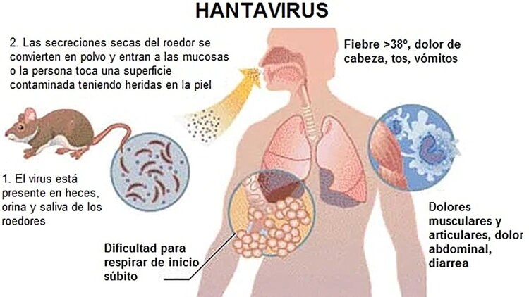 Hantavirus-1920-2.jpg