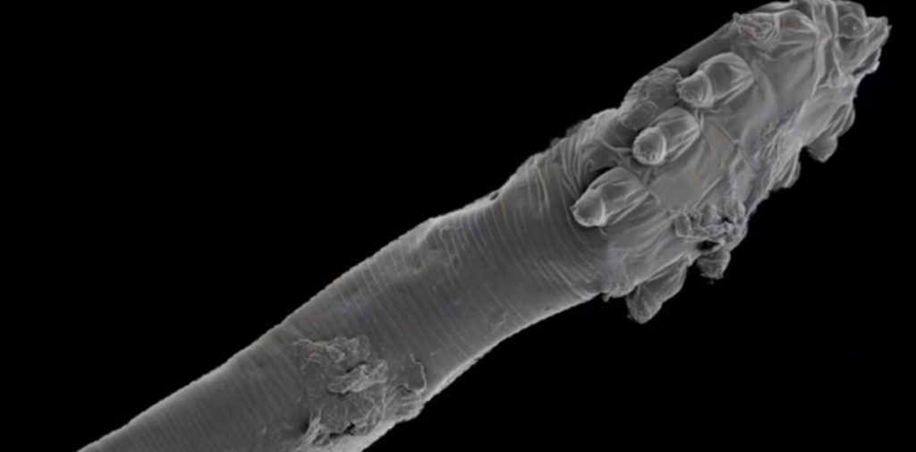 un-acaro-visto-con-microscopio___YTJCRdWqd_1256x620__1.jpg