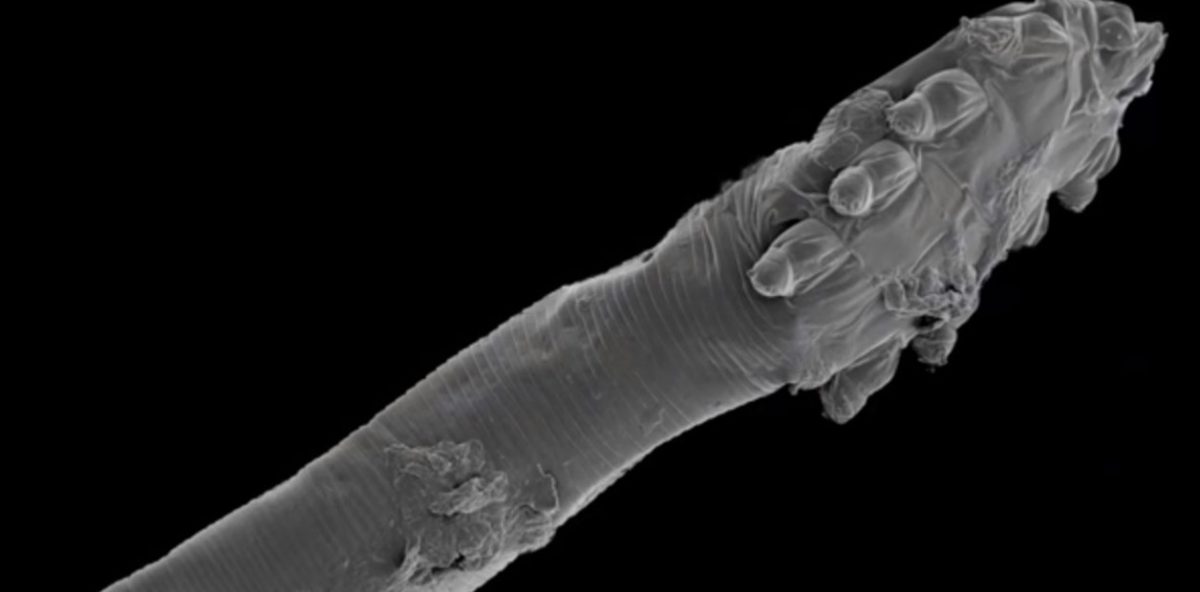 un-acaro-visto-con-microscopio___YTJCRdWqd_1256x620__1.jpg