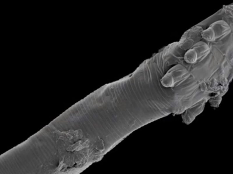 un-acaro-visto-con-microscopio___YTJCRdWqd_1256x620__1.jpg