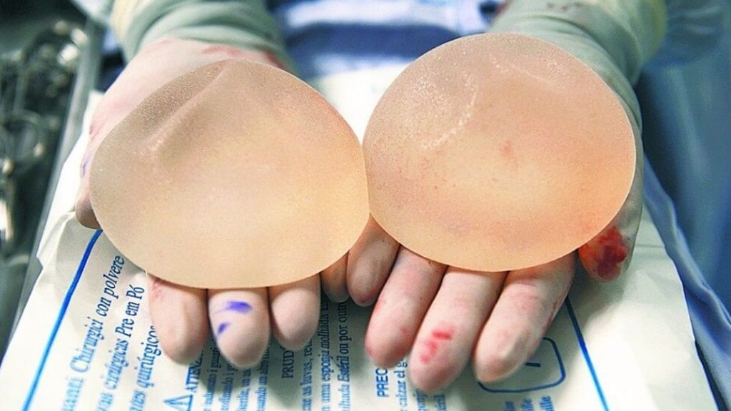 implantes_mamarios_biocelll_allergan_1.jpg_429366282.jpg