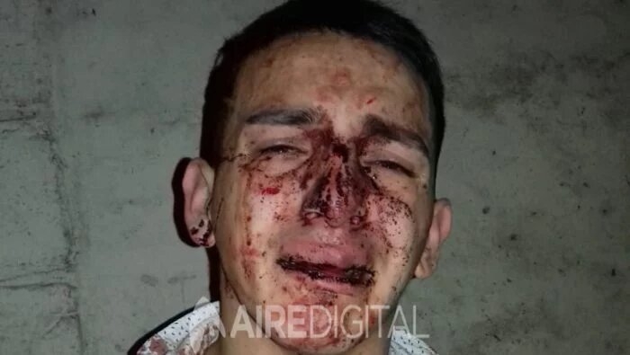 violencia-patovica-en-santa-fe2-700x395.jpg