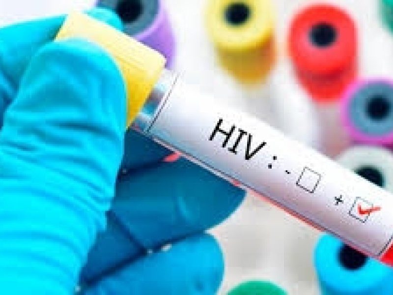 hiv.jpg
