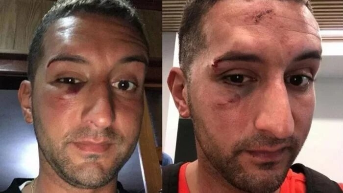 Turista-golpeado-700x395.jpg