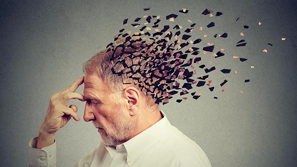 alzheimer.jpg
