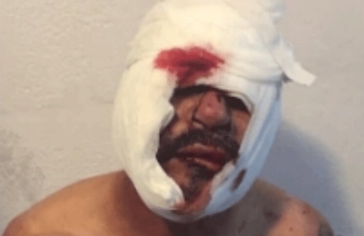 Descubrieron-a-un-hombre-violando-a-un-nene-de-3-años-y-los-vecinos-le-desfiguraron-la-cara-4-1.jpg