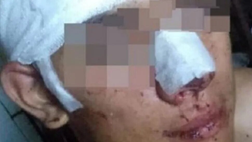 herido_1_crop1579715718163.jpg_1734428432.jpg