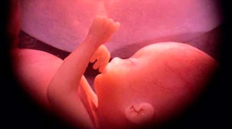 Bebe30semanas-Ivon19-Wikipedia-(CC-BY-SA-4.0)-15092019.jpg