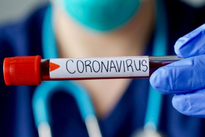 coronavirus (1).jpg