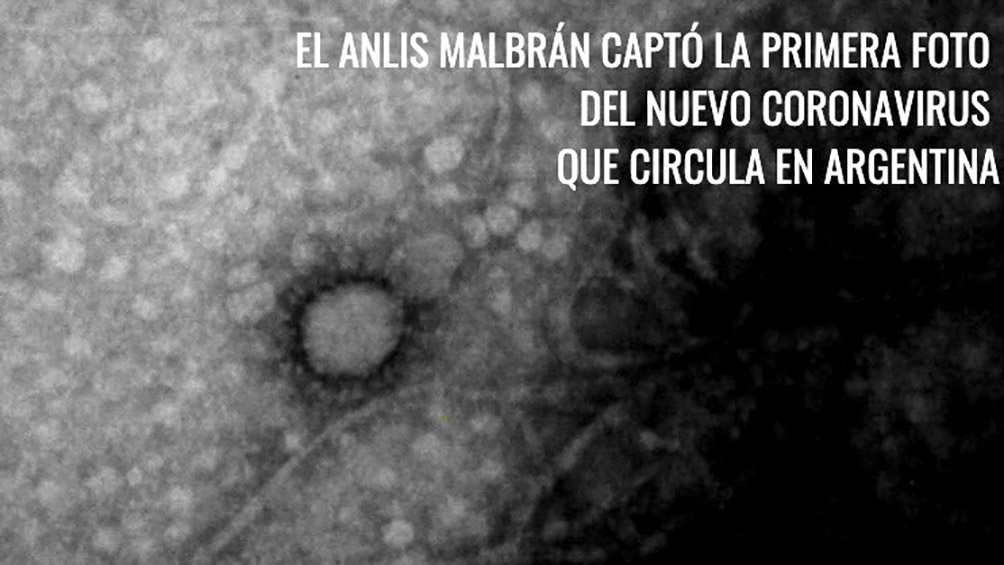 coronavirus foto.jpg