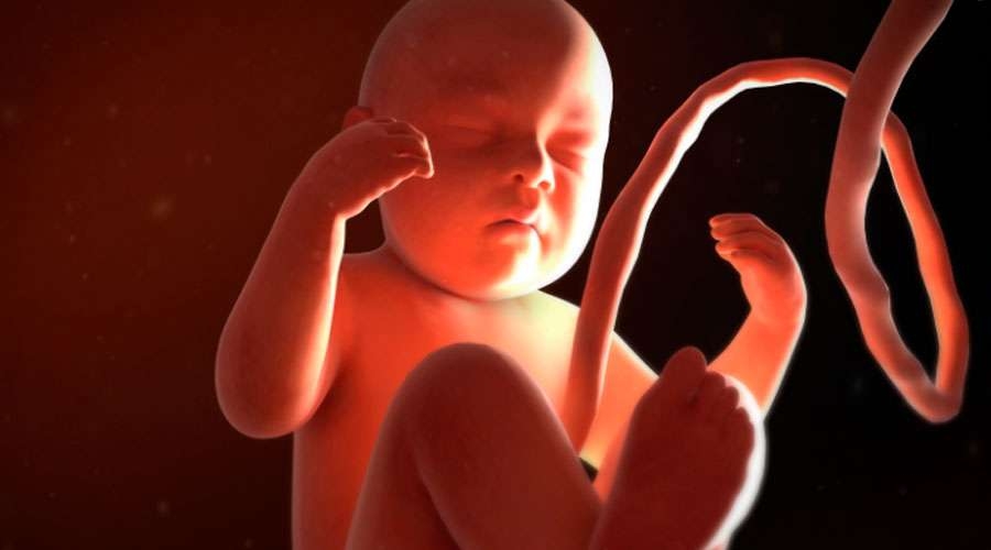 Bebe-medicalgraphics-(CC-BY-ND-4.0)-17042020.jpg