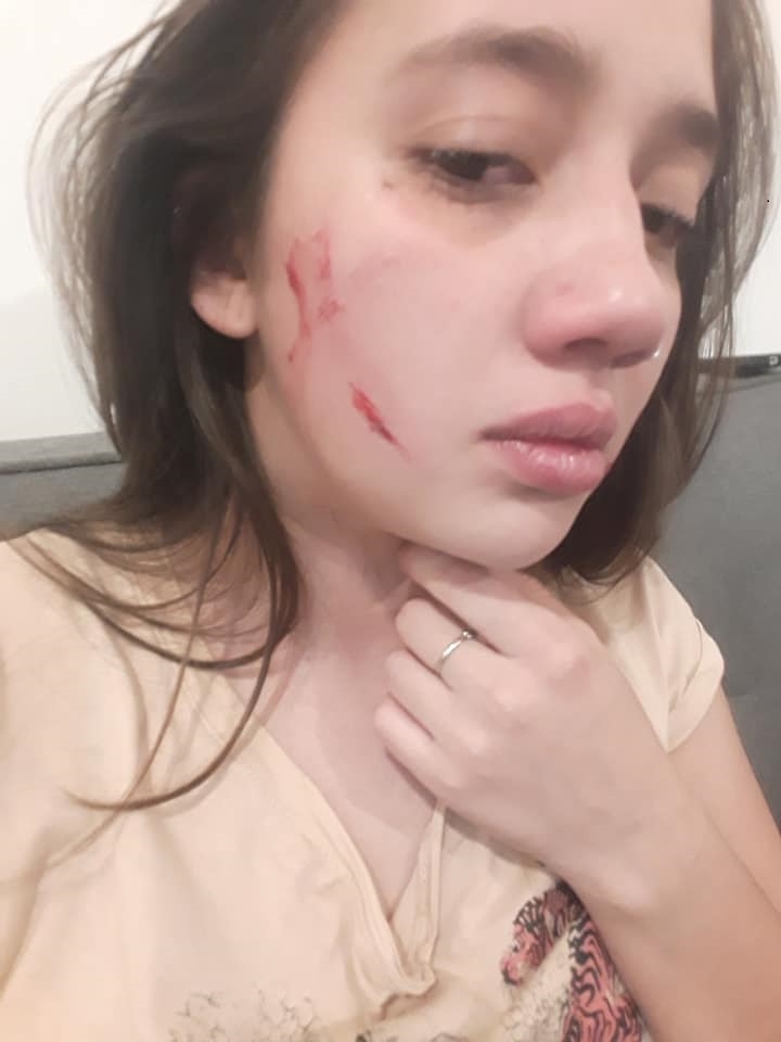 agresion1.jpg
