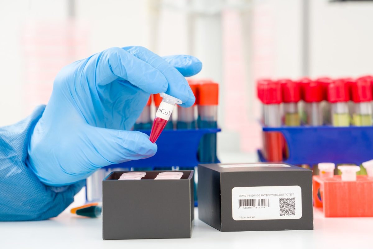 coronavirus-covid-19-pruebas-serológicas-América-Latina-Coronavirus-tests-anticuerpos-min.jpg
