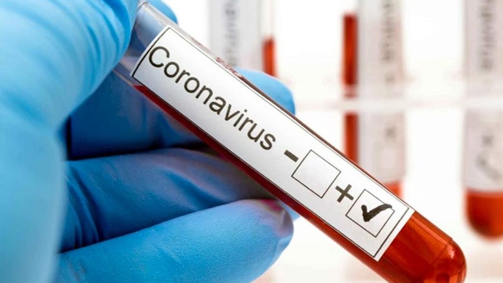 coronavirus-positivo-1280x720.jpg