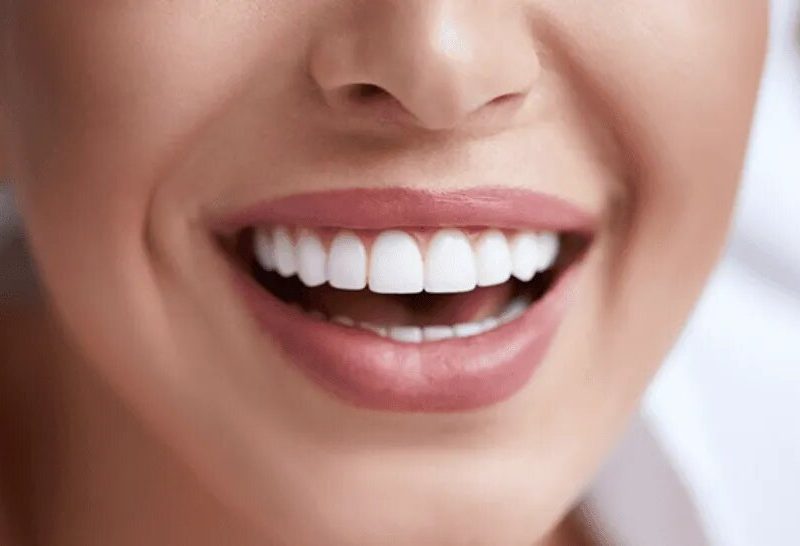 sonrisa_crop1601357052633.png_1734428432.jpg