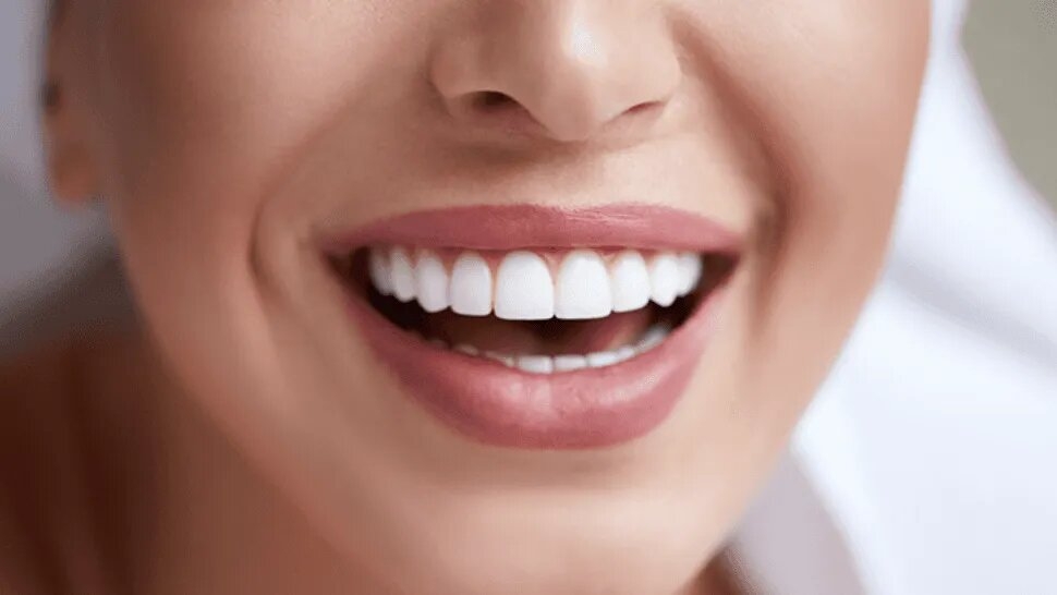 sonrisa_crop1601357052633.png_1734428432.jpg