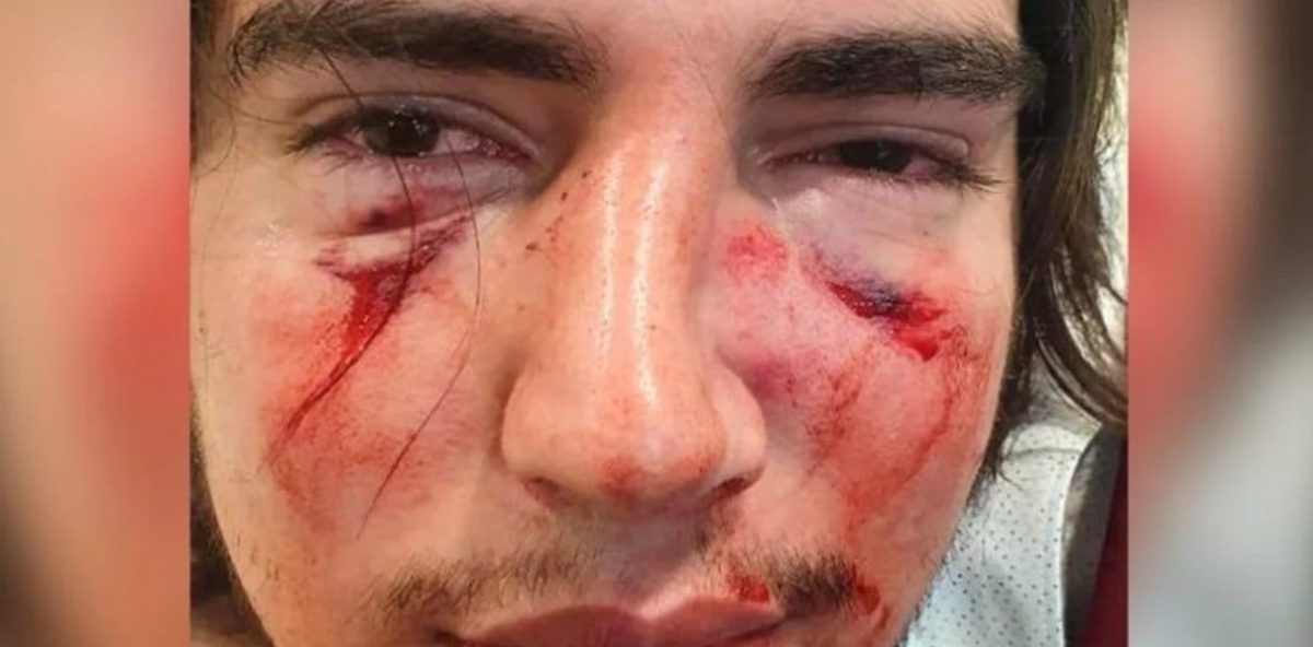 la-cara-desfigurada-del-joven___v--1yHRCW_1256x620__1_1.jpg