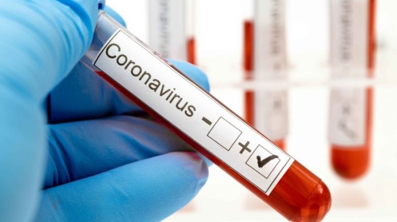 20200405202550_main-coronavirus-caso-positivo-generica-shutterstock-1654957318.jpg