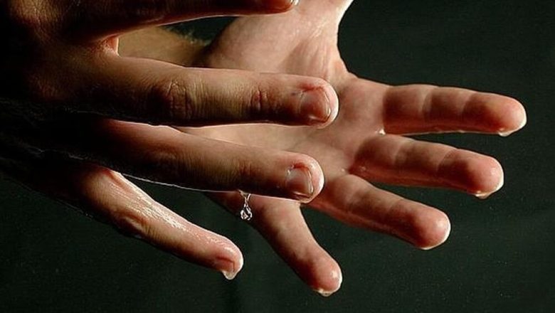 hiperhidrosis.jpg