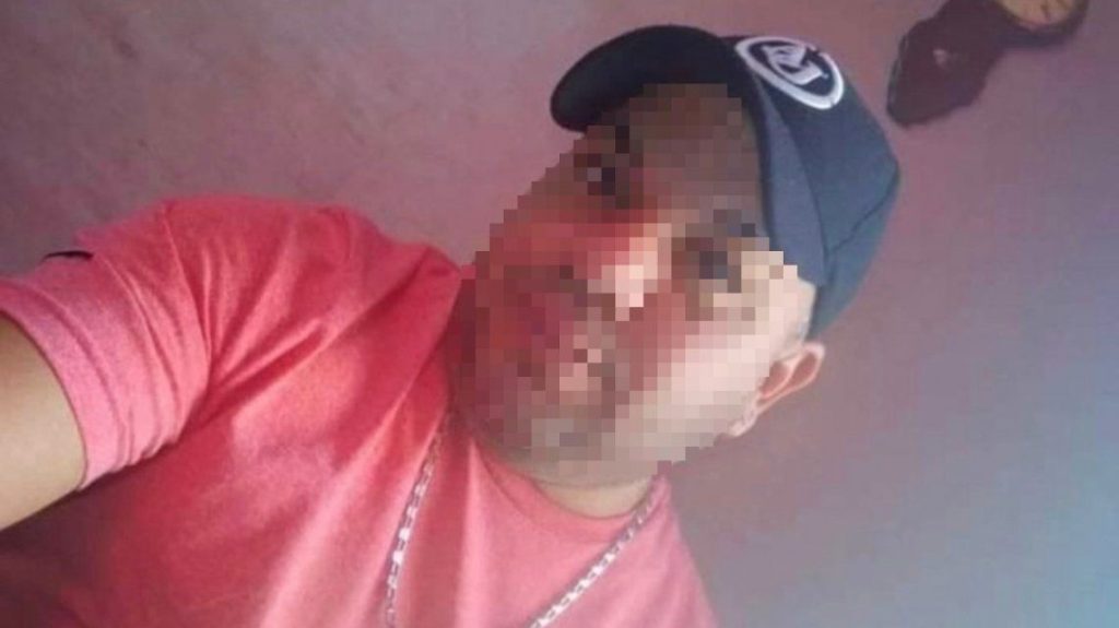 violencia-genero-arrecifes-golpeo-su-pareja-y-le-hizo-perder-un-embarazo-cinco-meses.jpg