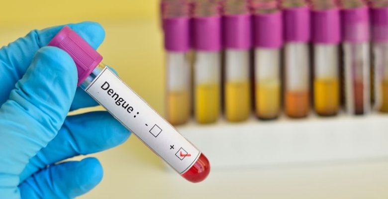 Hay-364-casos-de-dengue-confirmados-en-el-país.jpg