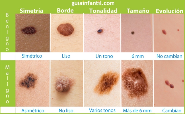 tablalunarescancer2-p.jpg