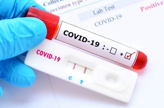 A-covid-aa.jpg