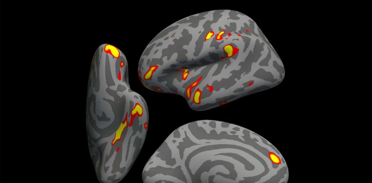 cerebro.jpg