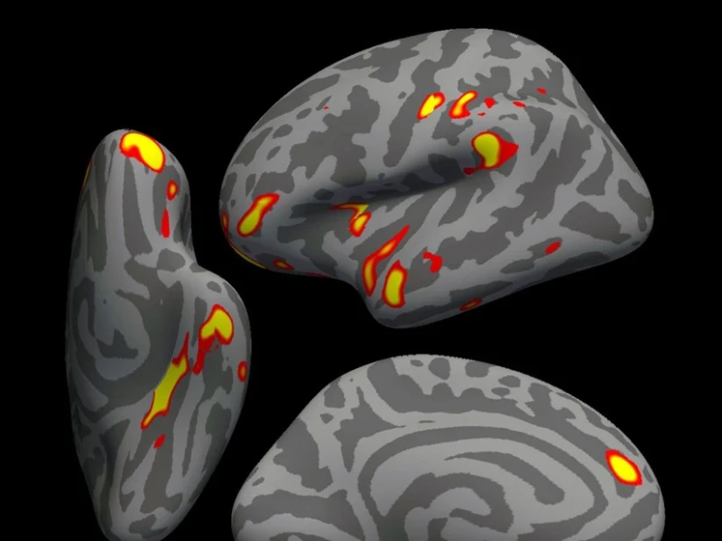 cerebro.jpg
