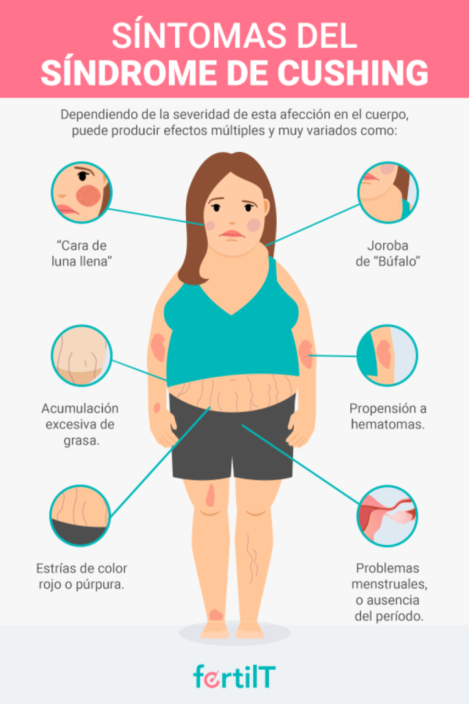 cuales-son-los-sintomas-del-sindrome-de-cushing-opt.png