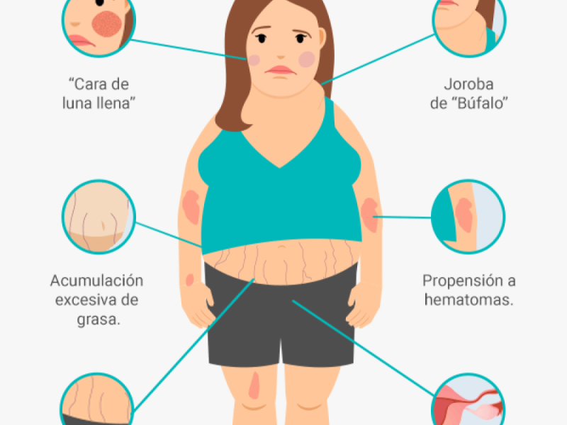 cuales-son-los-sintomas-del-sindrome-de-cushing-opt.png