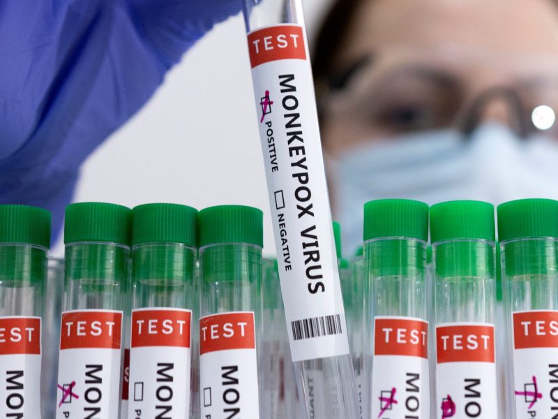107065671-16533303872022-05-23t182142z_1804853614_rc25du9tk905_rtrmadp_0_health-monkeypox.jpeg