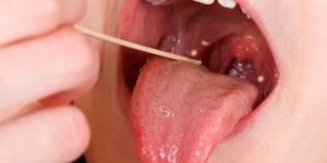 786546-faringitis.jpg