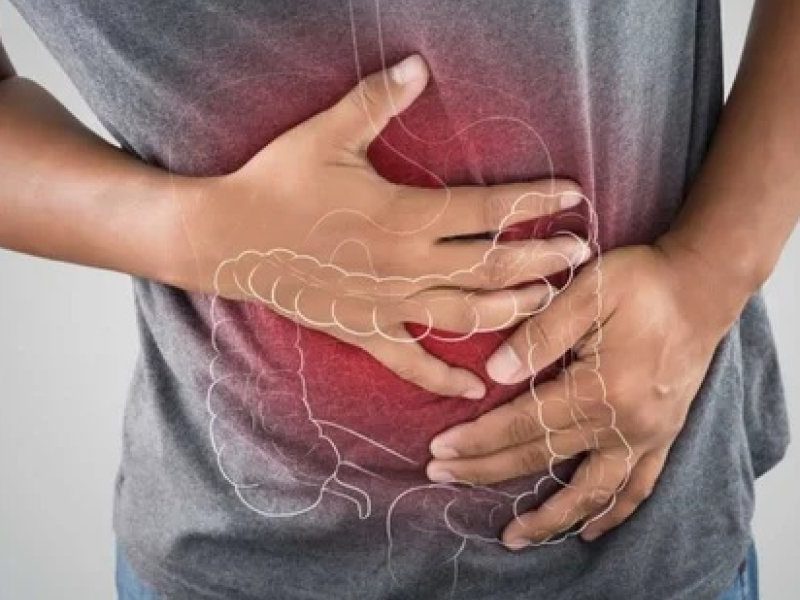 COLITIS.jpg