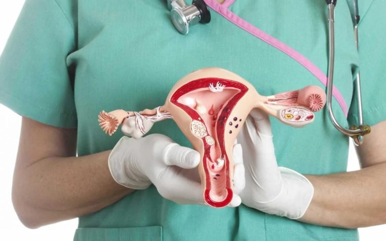 CÁNCER DE OVARIO.jpg