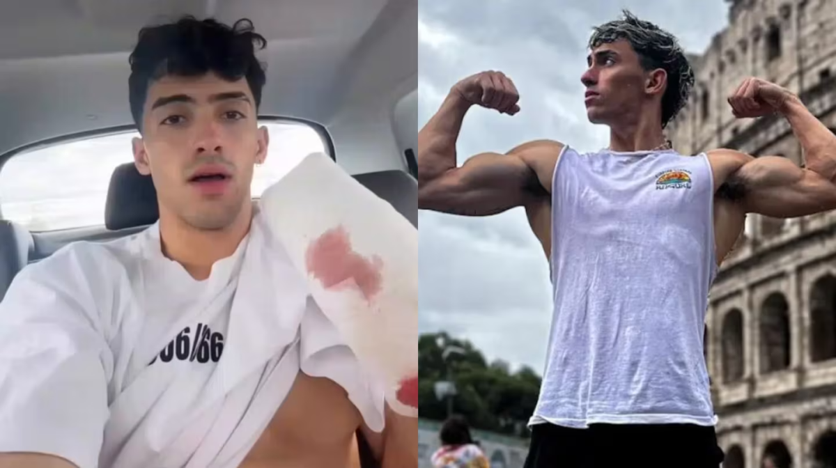 gero-arias-publico-un-video-en-donde-relato-como-fue-el-accidente-foto-instagram-gerooooarias20-GZ2F.png