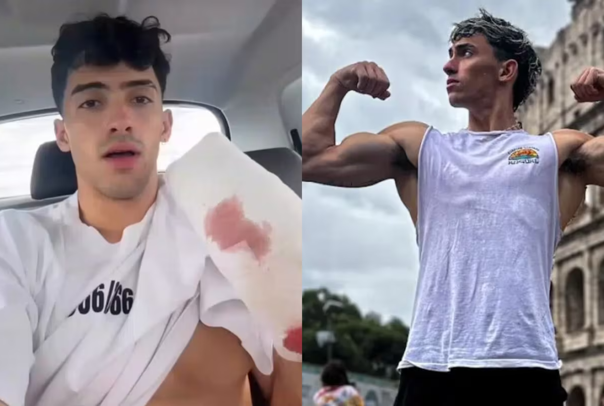 gero-arias-publico-un-video-en-donde-relato-como-fue-el-accidente-foto-instagram-gerooooarias20-GZ2F.png