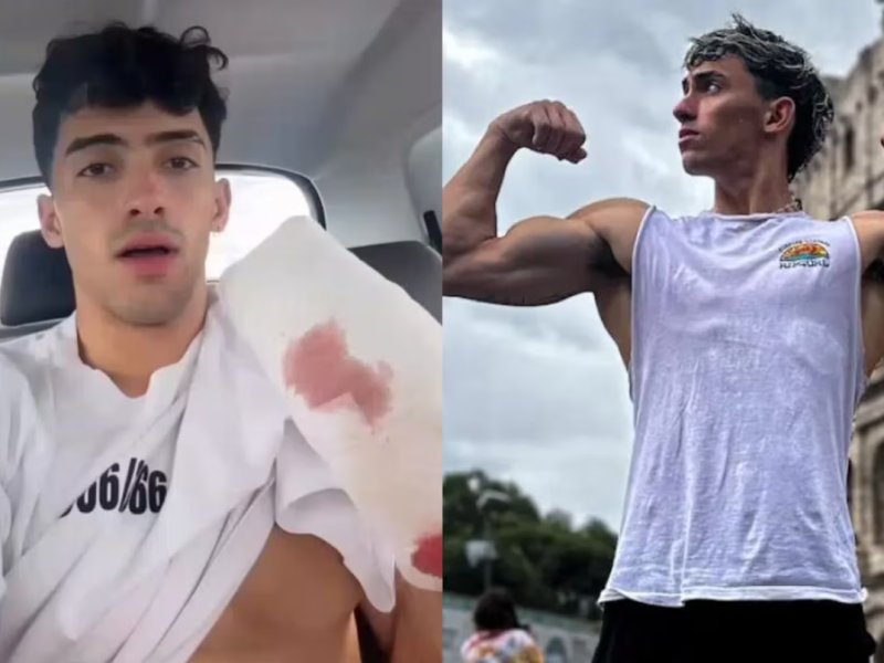 gero-arias-publico-un-video-en-donde-relato-como-fue-el-accidente-foto-instagram-gerooooarias20-GZ2F.png