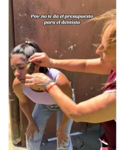 sapo-dolo de muelas.JPG