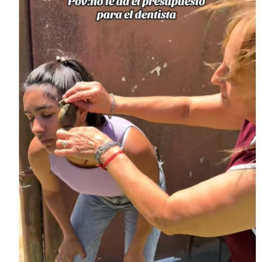 sapo-dolo de muelas.JPG