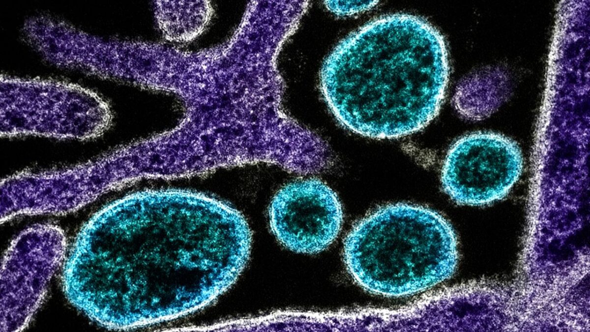 horiz-nipah-1-00-00-03-05-still001-20260130220937682-20260130220953737.jpg