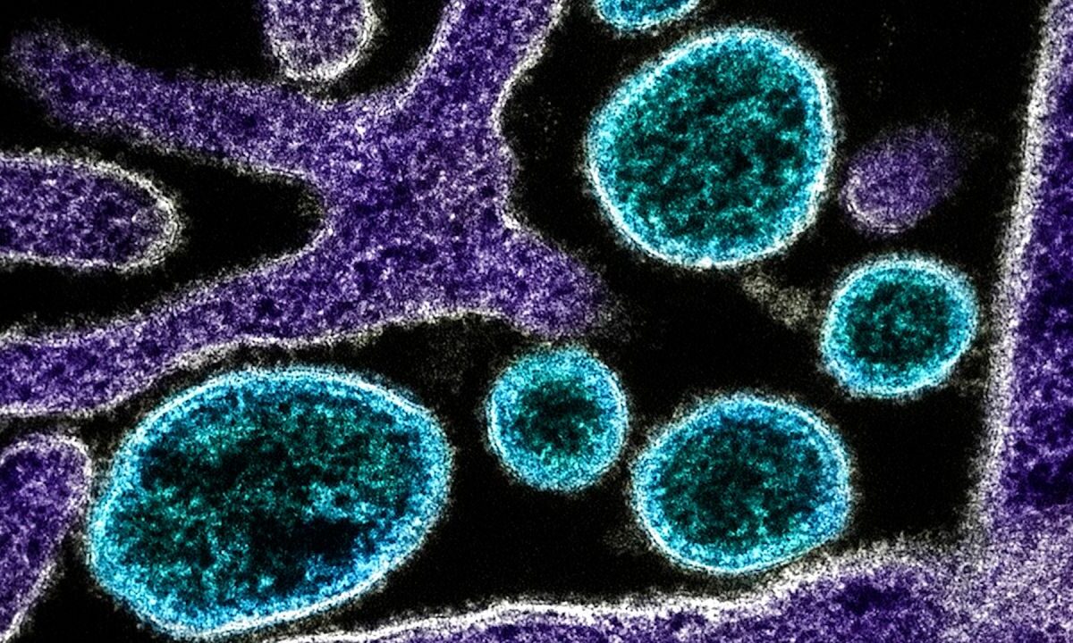 horiz-nipah-1-00-00-03-05-still001-20260130220937682-20260130220953737.jpg