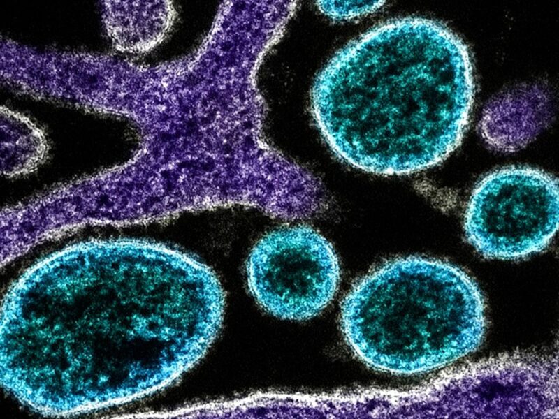 horiz-nipah-1-00-00-03-05-still001-20260130220937682-20260130220953737.jpg